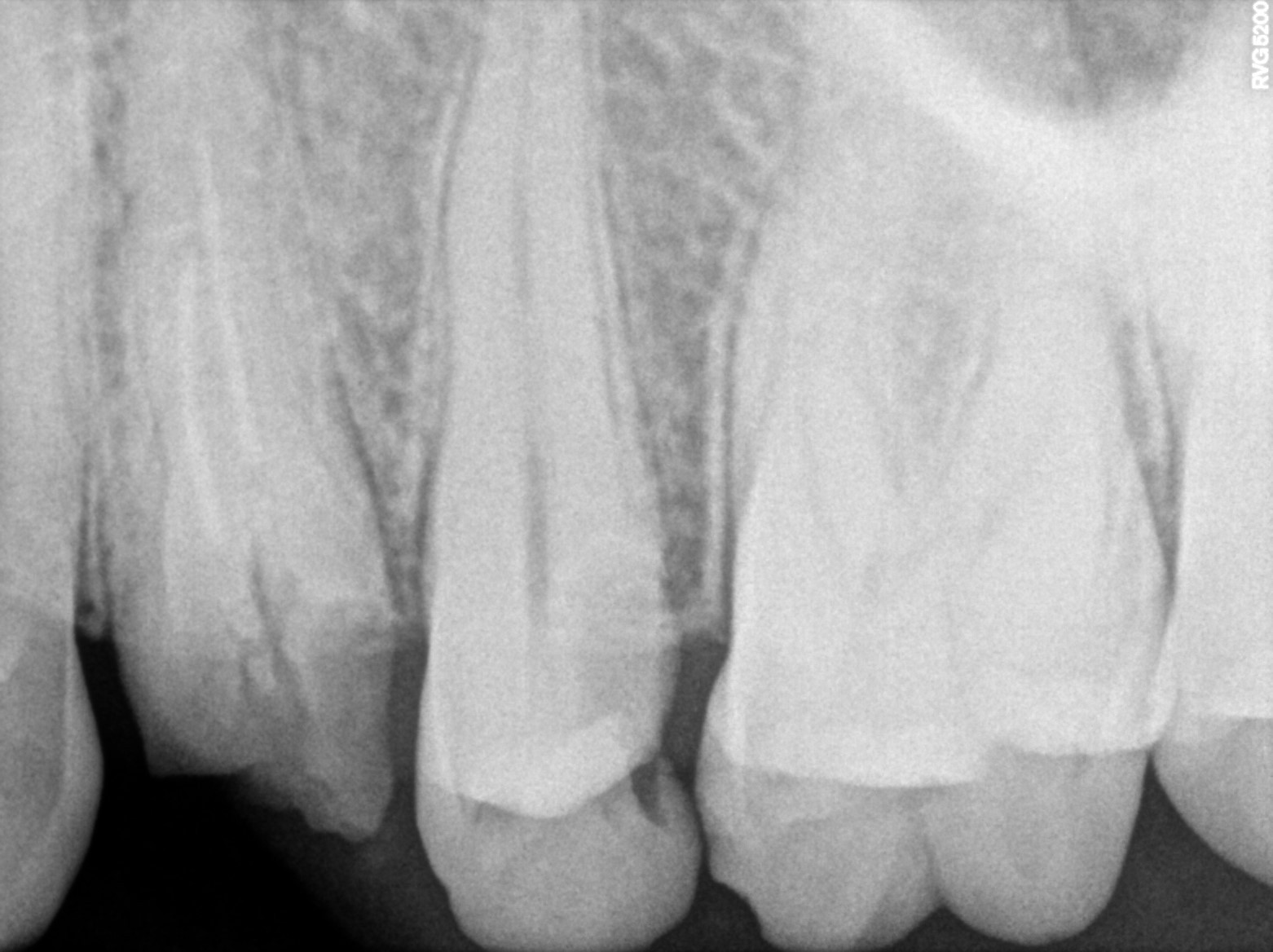 Dental X-ray